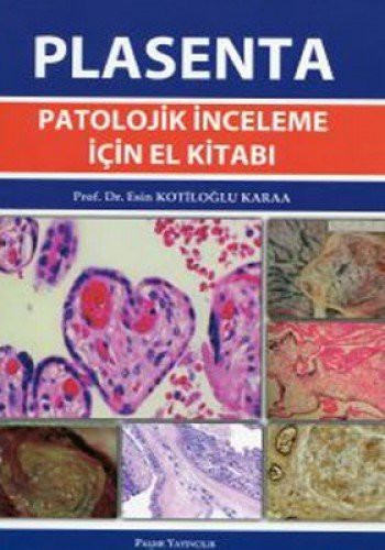 Plasenta Patolojik İnceleme İçin El Kitabı kitap kapağı