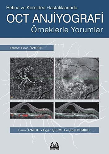Retina ve Koroidea Hastalıklarında OCT Anjiyografi kitap kapağı